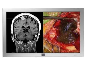 Picture of 42" Full HD Large-Screen Surgical Display